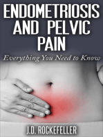 Endometriosis and Pelvic Pain: Everything You Need to Know