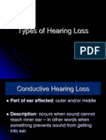 Types of Hearing Loss