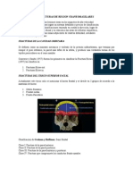 Fracturas de Region Craneomaxilofacil