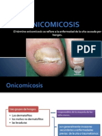 Onicomicosis