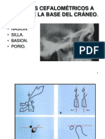 Puntos Cefalometricos