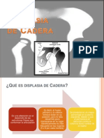 Displasia de Cadera Diapositivas