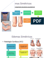 Edemas Simétricos