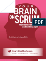 Your Brain On Scrum