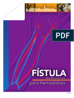 Fistula Spanish