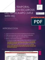 Esclerosis Mesial Temporal (Emt)