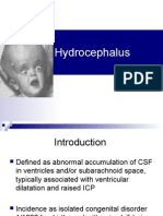 Hydrocephalus