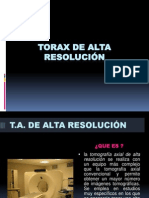 Exposicion de Torax Alta Resolucion