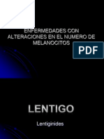 Lentigo