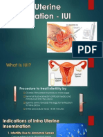 Intra Uterine Insemination - IUI