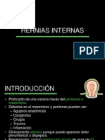 Hernias Internas