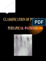 Classification of Pulpal & Periapical Pathosis