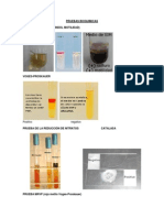 Fundamentos Pruebas Bioquimicas y Medios de Cultivo