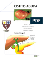 Colecistitis Aguda