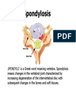 Spondylosis