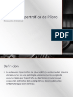 Estenosis Hipertrófica de Píloro y Resección Intestinal