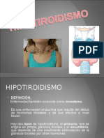 HIPERTIROIDISMO