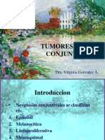 Tumores de La Conjuntiva