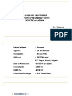 A Case of Ruptured Ectopic Pregnency With Severe Anaemia.: Dr. Shamim Dr. Sarfaraz Dr. Shadab