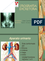 Urografía Excretora