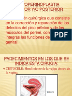 Colpoperinoplastia Anterior y