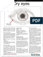 Dry Eyes: Red, Dry and Stinging Eye