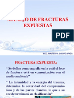 Fractura Expuesta