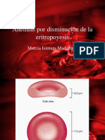 21 - Anemias Por Disminución de La Eritropoyesis