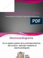 Electrocardiograma Expo