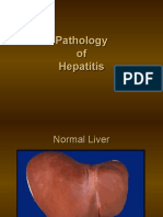 Viral Hepatitis