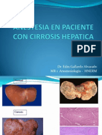 Anestesia en Paciente Con Cirrosis Hepatica