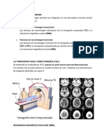 Técnicas de Neuroimagen