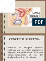 Hernia Inguinal 120912212802 Phpapp01