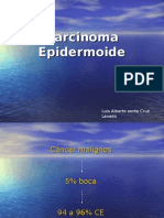 Carcinoma Epidermoide