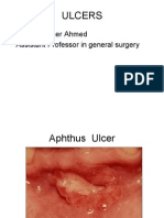 Ulcer, Cyst, Tumoures, Sinus, Fistulla