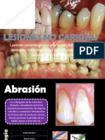 Lesiones No Cariosas 