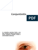 Conjuntivitis