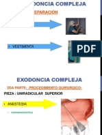 Exodoncia Compleja