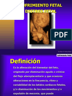 Sufrimient Fetal Agudo