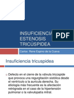 Insuficiencia y Estenosis Tricuspidea