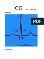 ECG Made Easy by Mallareddy Sripuja