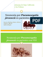 Neumonía Por Pneumocystis Jirovecii en Pacientes Con VIH