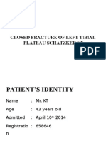 Closed Fracture Tibial