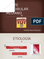 Quiste Mandibular Mediano