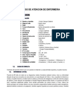 Proceso de Atencion de Enfermeria - Cirugia A - Neurologia - Hematoma Subdural Cronico