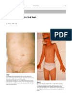 MUMJ Pediatric Rash Quiz