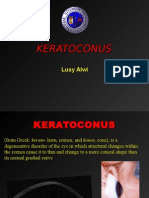 KERATOKONUS