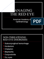 Managing The Red Eye