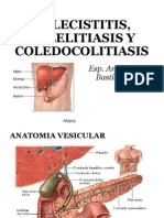 Colecistectomia