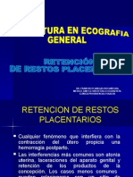 II. Retencion de Restos Placentarios